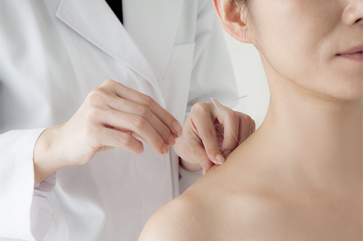Acupuncture London